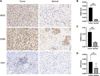 Prognostic significance of CKAP2L expression in patients with clear cell renal cell carcinoma